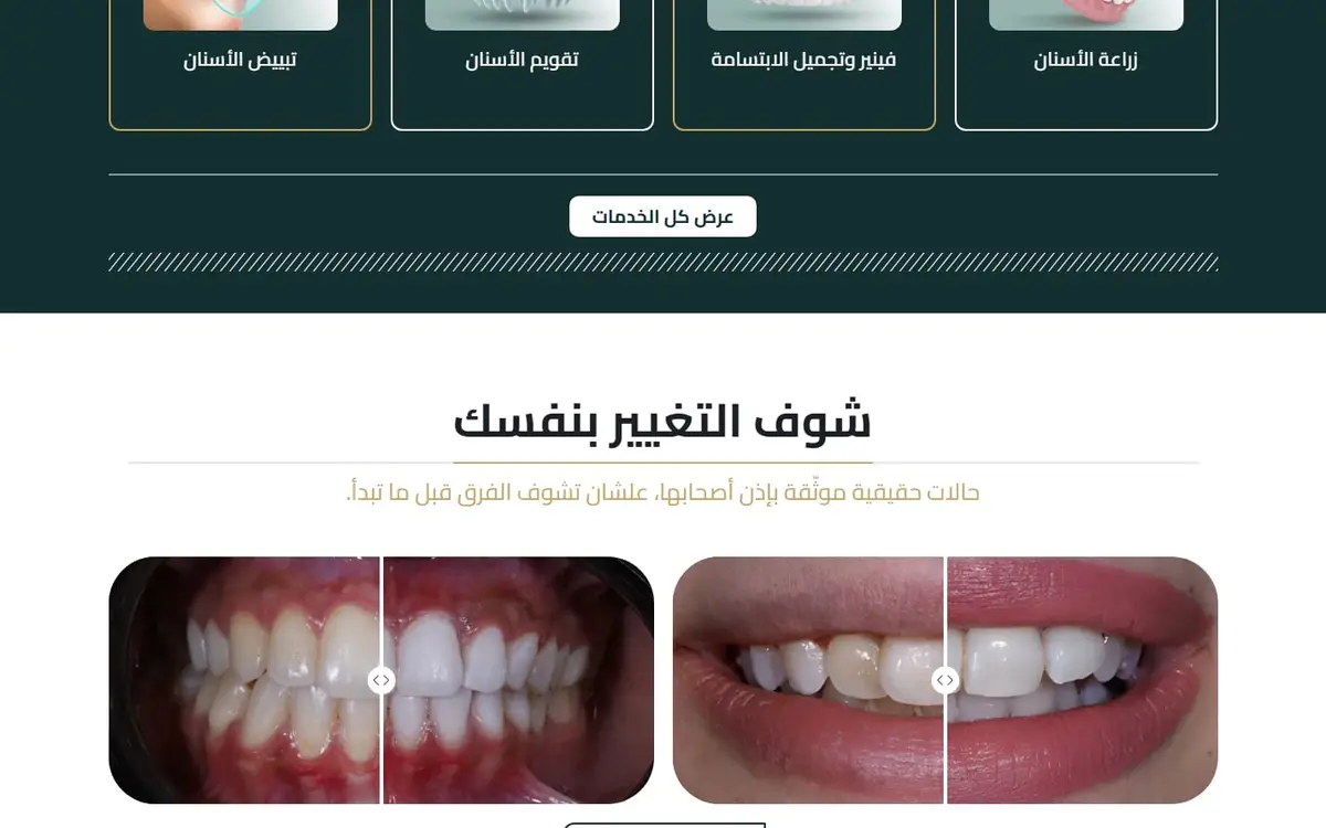 مؤمن دنتال أوفيس: موقع عيادة أسنان مع حجز وحالات قبل وبعد — gallery image 2